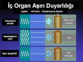 İç Organ Aşırı Duyarlılığı
